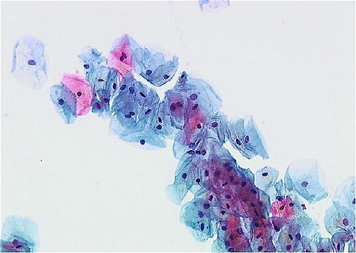 Basal